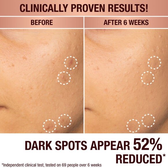 CHARLOTTE TILBURY DARK SPOT CORRECTING RADIANCE RECOVERY SERUM - Imagem 2